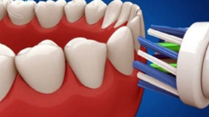 Brossage des dents et des gencives - Dentiste Toulouse