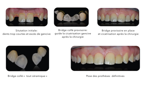 Parodontologie dentaire Toulouse